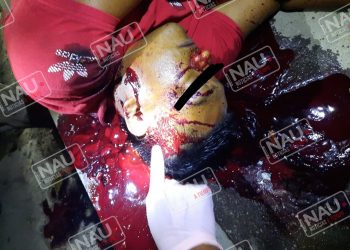 Le dieron 5 balazos en el momento que se encontraba ingiriendo bebidas embriagantes en Huehuetán