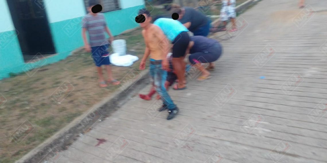 A hondureño le dieron dos cuchilladas en una riña en Matapa de Domínguez