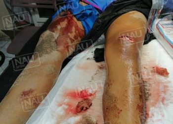 Lesionan a menor que intentaron abusar de ella