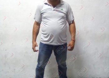 A pesar de que fue golpeada por su pareja, no quiso proceder