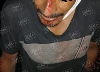 Vehículo no identificado atropelló a una persona en la carretera Tapachula – Jaritas