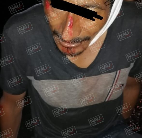 Vehículo no identificado atropelló a una persona en la carretera Tapachula – Jaritas