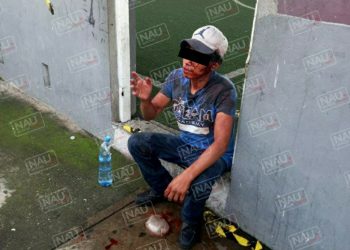 Le dieron una cuchillada en la cabeza tras registrarse una riña en la Colonia 5 de febrero