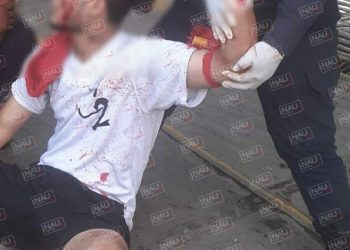 Lesionan a hondureño en una riña en plaza Kafeto.