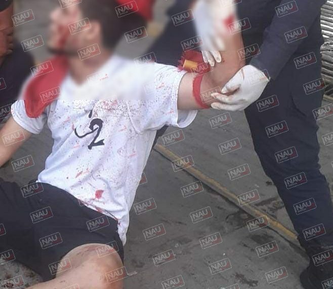 Lesionan a hondureño en una riña en plaza Kafeto.