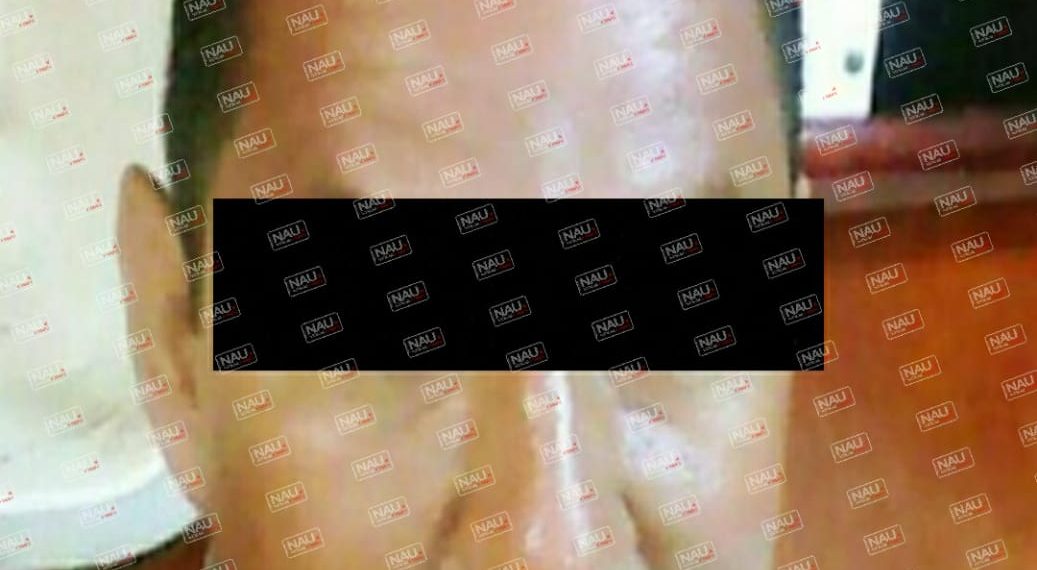 Marino le destroza la cara a una niña en Puerto Madero.