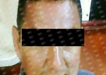 Marino le destroza la cara a una niña en Puerto Madero.