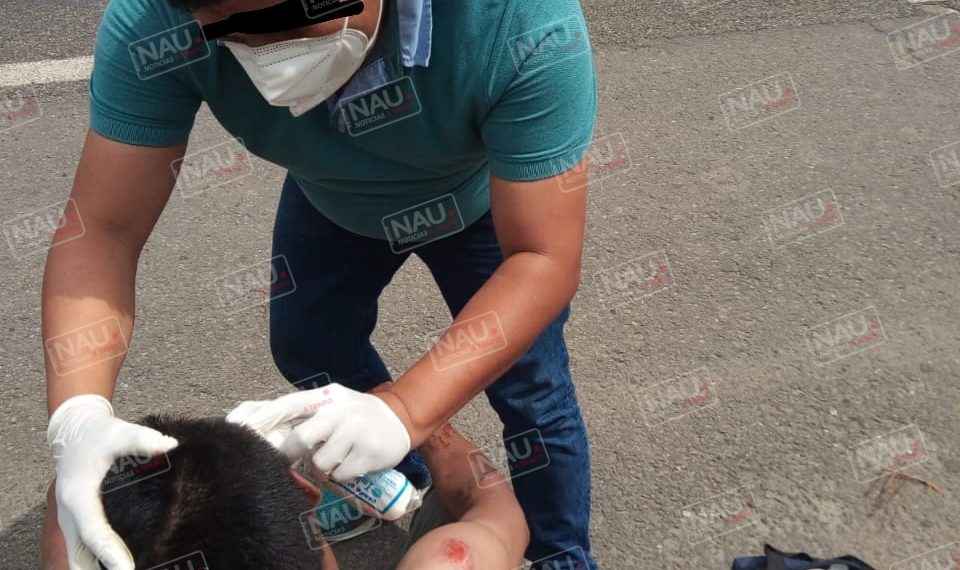 Atropellado en carretera Tapachula – Tuxtla Chico