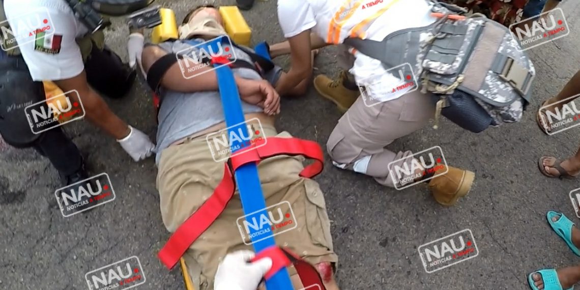 Grave persona atropellado en el Manzano.