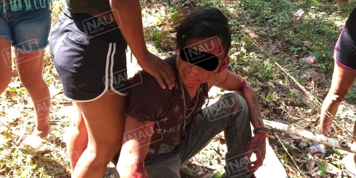 Dos lesionados al derrapar la motocicleta en que viajaban