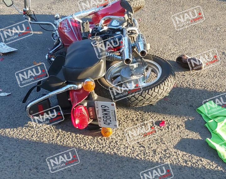 Motociclista lesionado en accidente casi pierde el pie.