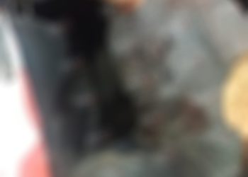 Le amputaron la mano en una riña