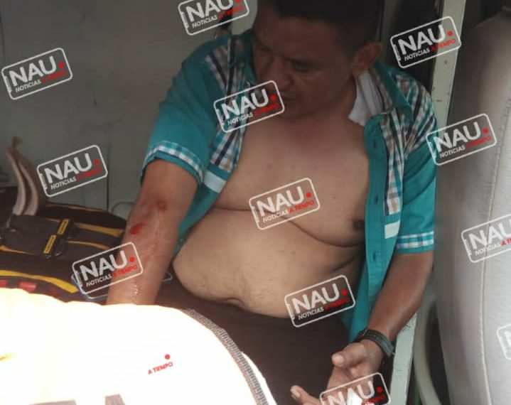 Empleado del IMSS agrede a Director General de NAU Noticias.