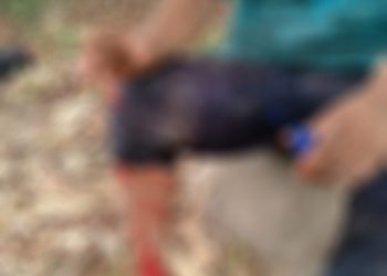 Fue arrollado por un vehículo