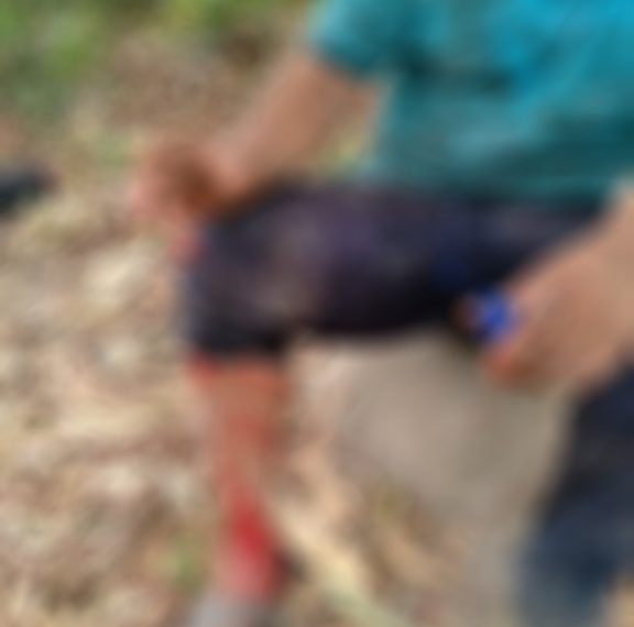 Fue arrollado por un vehículo