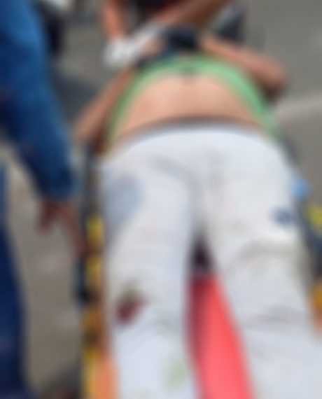 Motociclistas chocaron en el libramiento