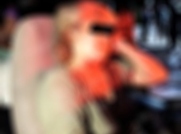 A señora le dieron un balazo en la cabeza con una escopeta