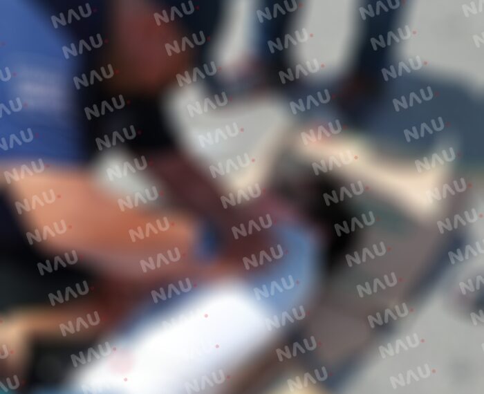 Joven se lesiona al sufrir una convulsión