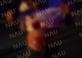 Con un cuchillo lo lesionaron en el estómago.