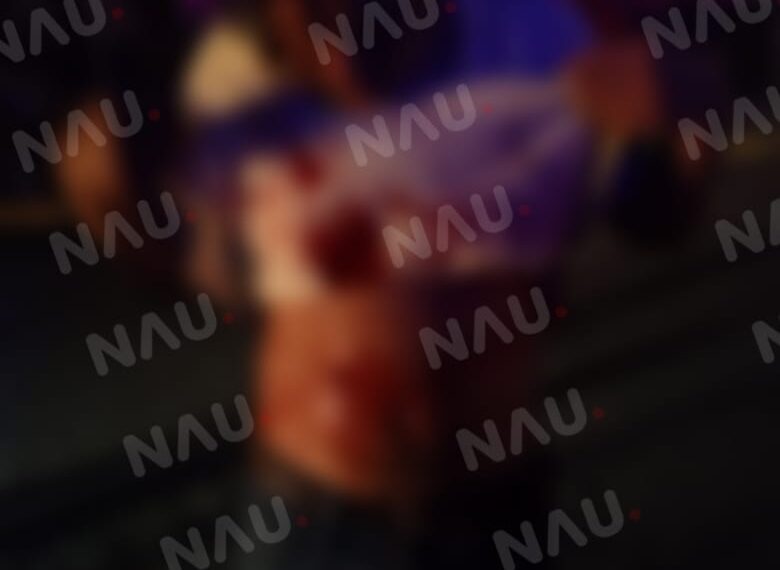 Con un cuchillo lo lesionaron en el estómago.