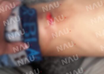 Un lesionado en riña