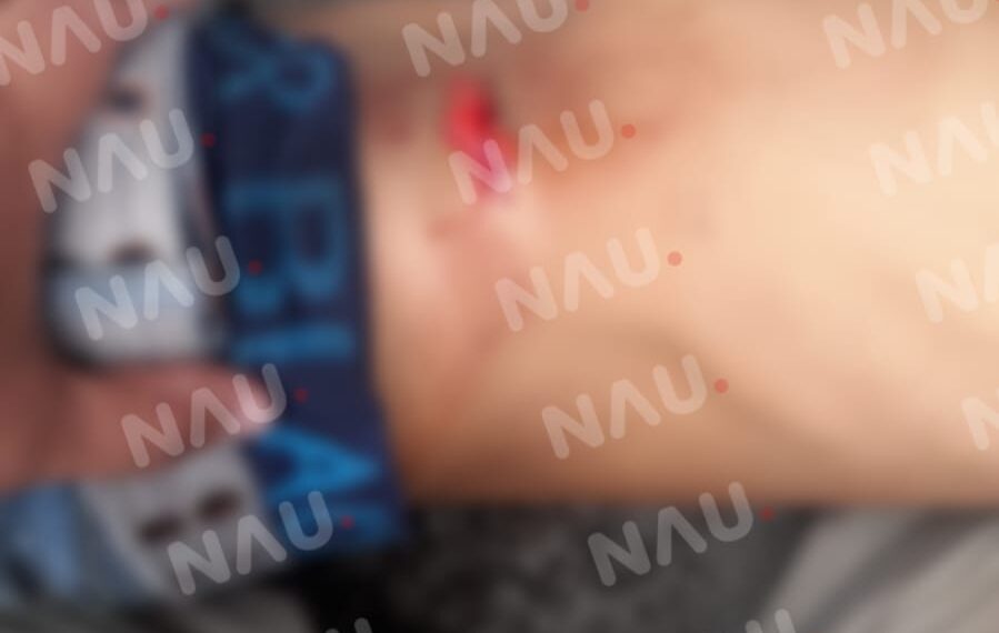 Un lesionado en riña