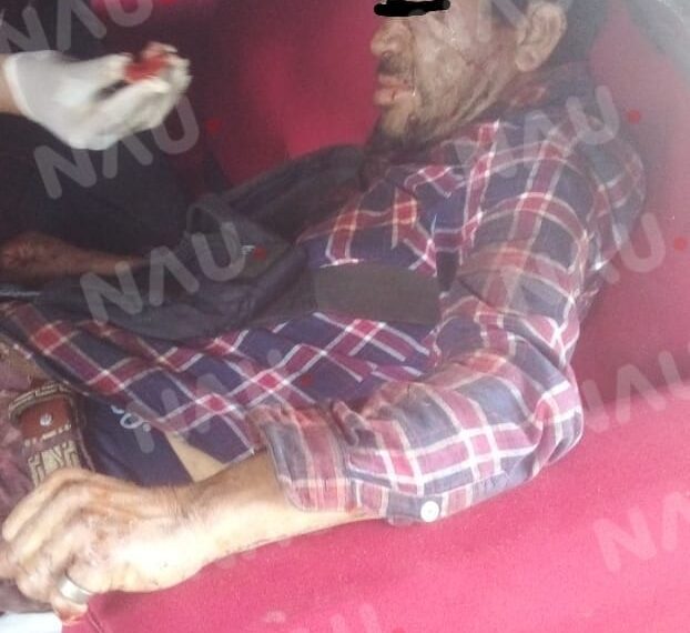 Lo lesionaron en una riña callejera