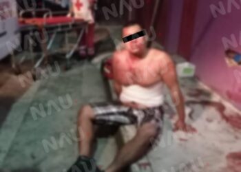 Lesionan a Guatemalteco de 8 cuchilladas