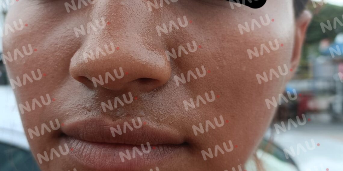 Fiscal del Ministerio Público se niega a atender a víctima de lesiones