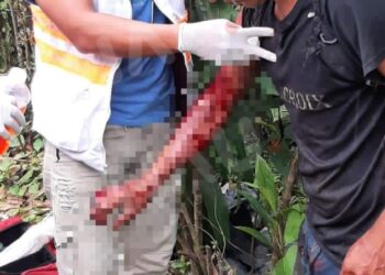 Casi lo matan en una riña en Cacahoatán