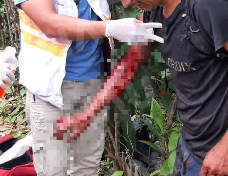 Casi lo matan en una riña en Cacahoatán