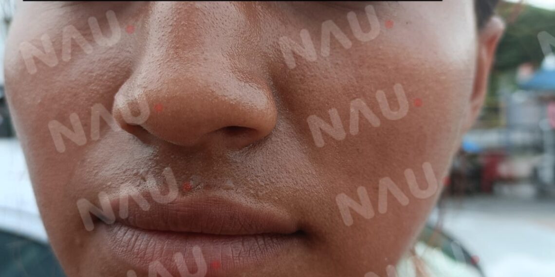 Fiscal del Ministerio público se niega a atender a víctima de lesiones.