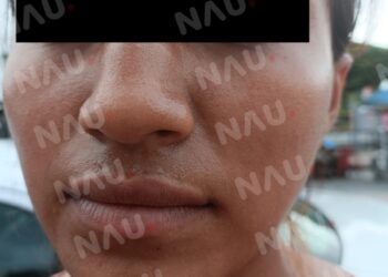 Fiscal del Ministerio público se niega a atender a víctima de lesiones.