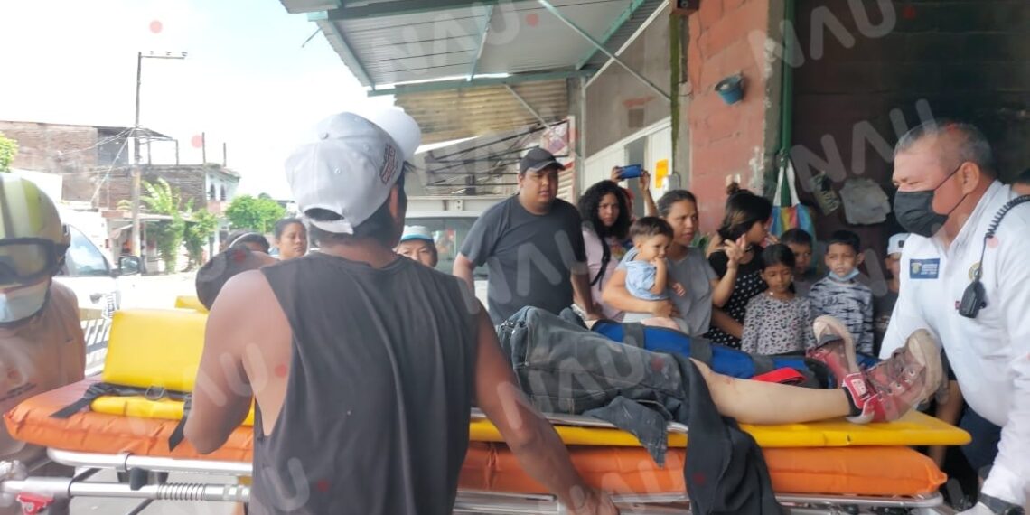 Hondureño lesionado al explotar un compresor