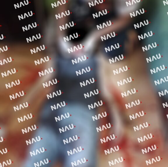 Intentó acabar con su vida