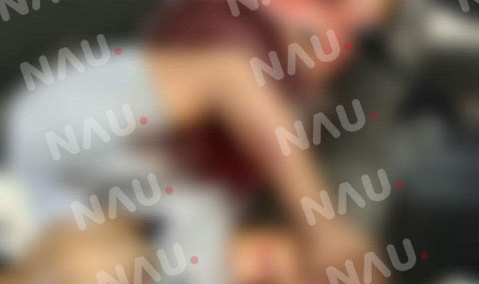 Le dieron tres cuchilladas y murió en un vehículo en la carretera costera