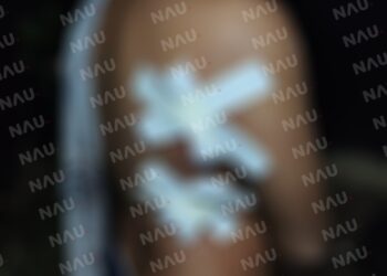 Tres lesionados deja una riña en la colonia Primavera