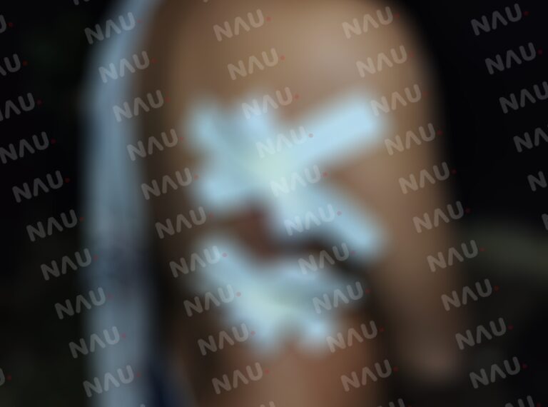 Tres lesionados deja una riña en la colonia Primavera