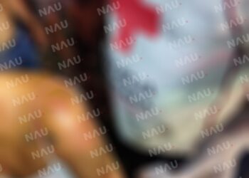 Fue lesionada por su pareja en la colonia Confeti