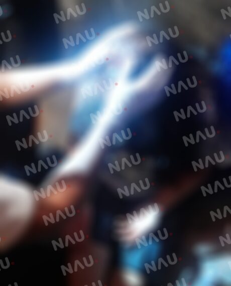 Venezolana fue lesionada por su pareja en la colonia Obrera