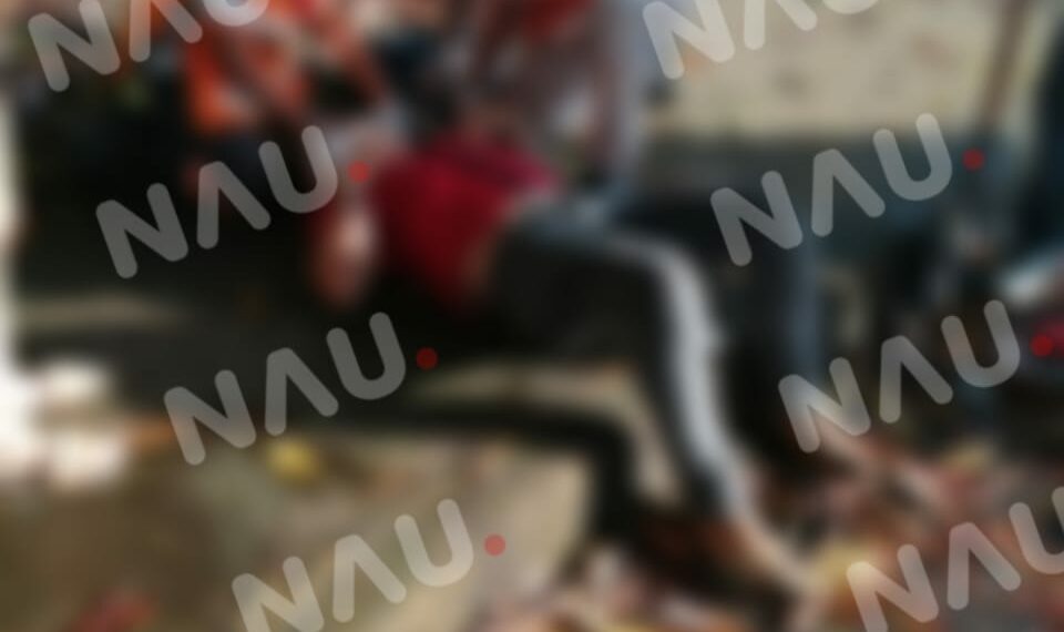 Motociclista lesionado al ser impactado por un vehículo que se dio a la fuga