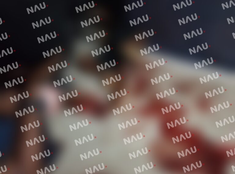 Riña deja tres migrantes lesionados en el centro de Tapachula