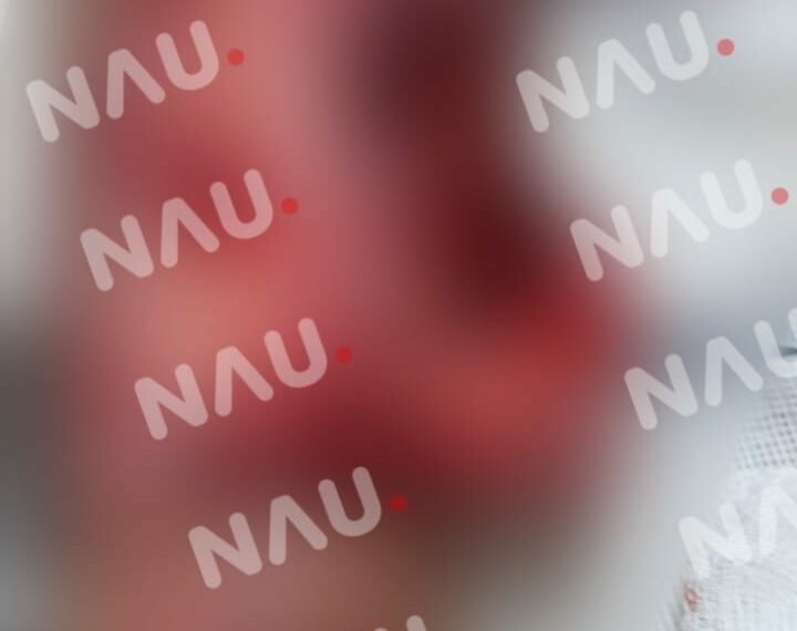 Dos motociclistas lesionados al chocar contra un taxi