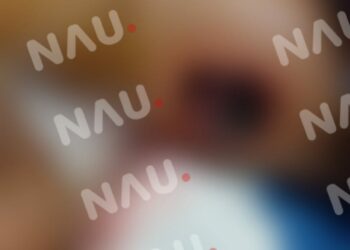 Víbora tamagas ataca a Menor de 7 años en Mapastepec