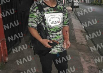 Intentan asesinar a mesero del bar la María de la zona diamante