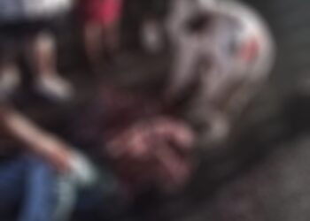 Lesionado al derrapar en su motocicleta