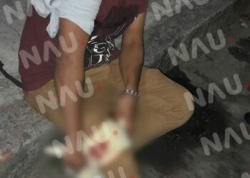 En asalto lo lesionaron con arma blanca