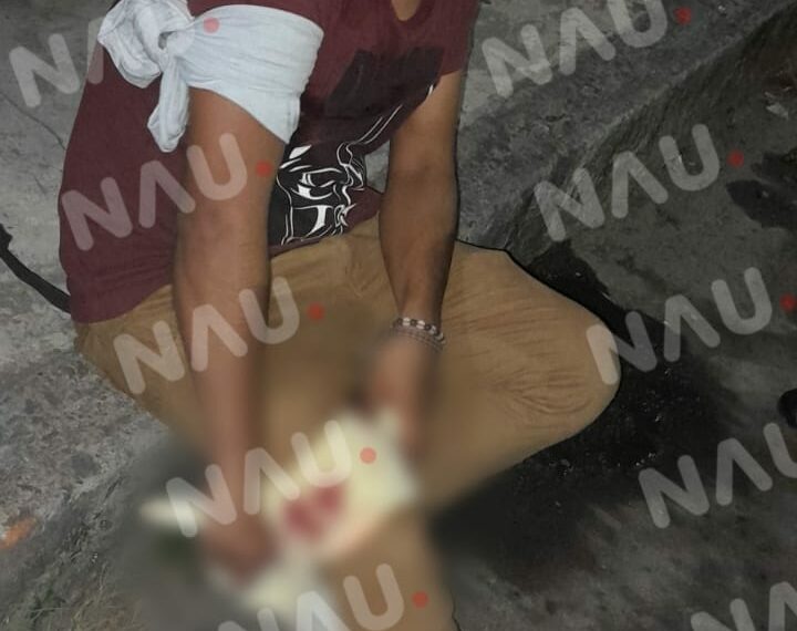 En asalto lo lesionaron con arma blanca