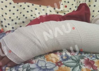 Este miércoles darán de alta a menor mordida por Pitbull en la colonia los Llanes 3