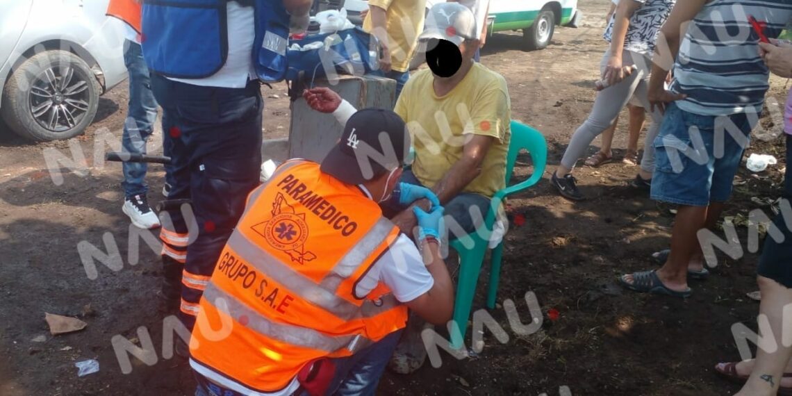 Lesionan a un albañil de una obra